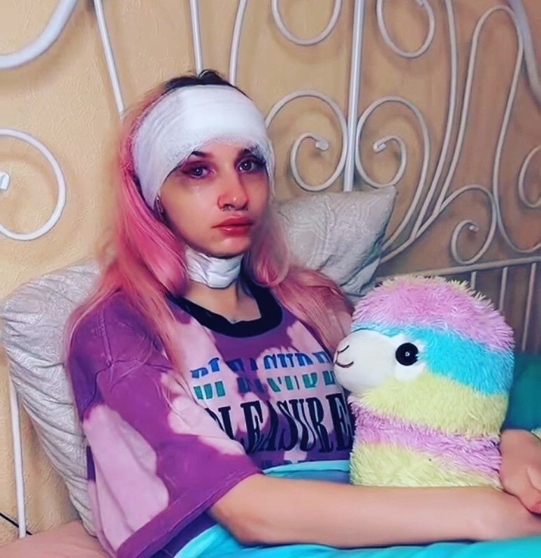 Стала более женственной как выглядит стримерша Даша Корейка после операции